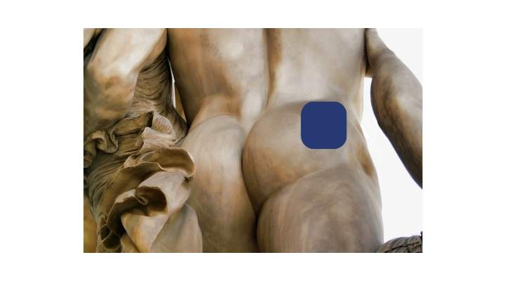 Image of the behind of a statue with a dark blue rectangle superimposed on the upper outer corner of the right buttock.  Estimated placement of Testopel pellet placement.