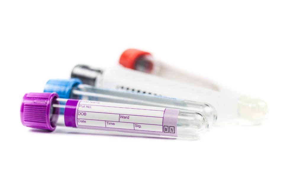 Image of four empty vacutainer blood collection vials for bloodwork labs. The image is focused on the first vial, which has a purple top and purple, white, and lavender label. The second tube has a blue top, the third has a black top, and the final tube has a red top.